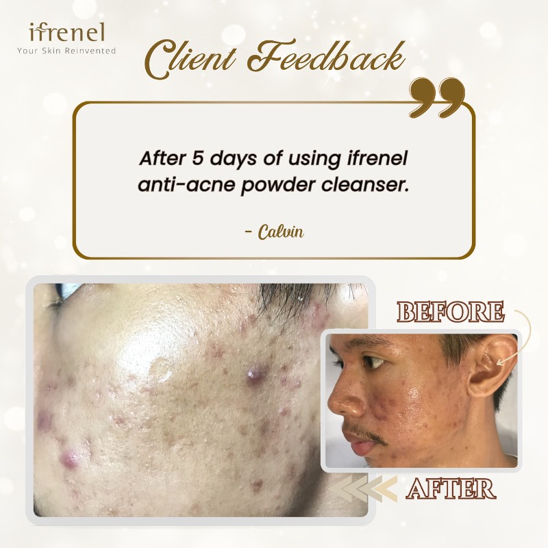 Ifrenel testimonial